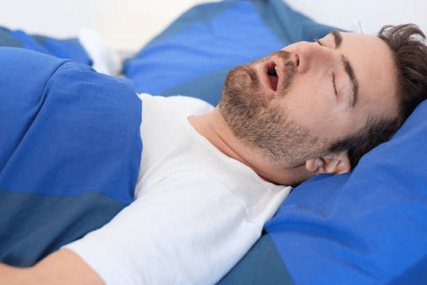 Causes Of CPAP Dry Mouth