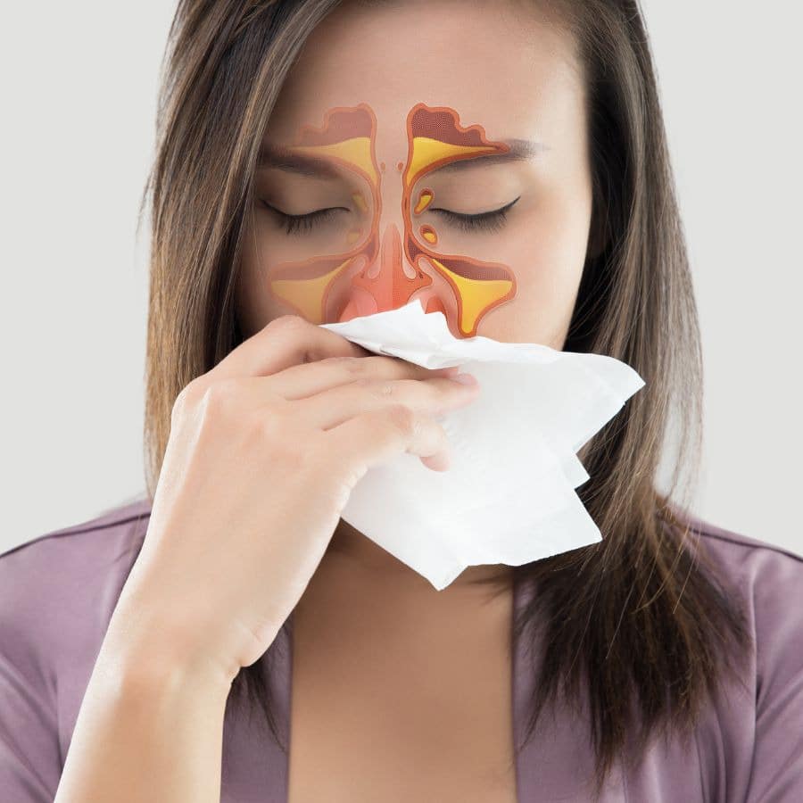 CPAP Causes Of Sinus Congestion