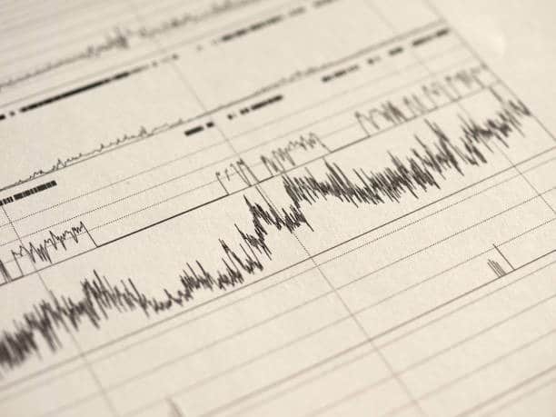 What Is The Apnea Hypopnea Index AHI 